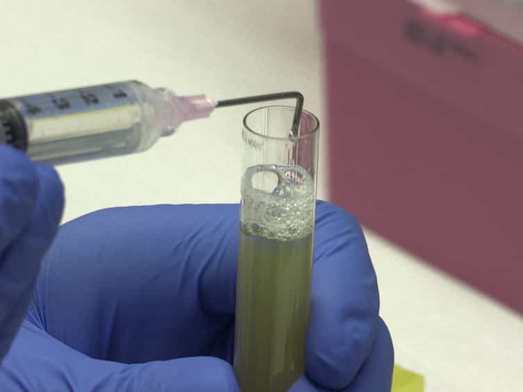 Isolation of High-density Lipoproteins for Non-coding Small RNA Quantification