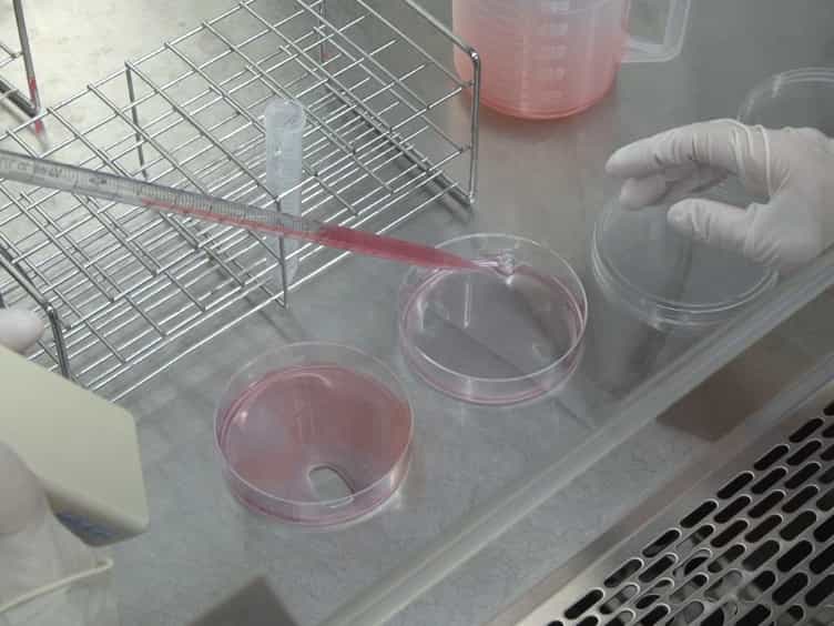 Creation and Transplantation of an Adipose-derived Stem Cell ASC Sheet in a Diabetic Wound-healing Model