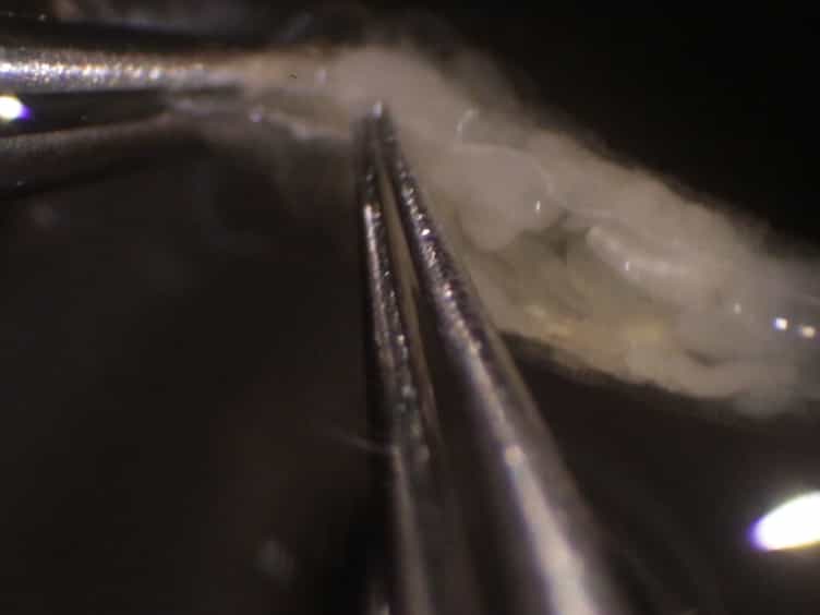 Methods to Examine the Lymph Gland and Hemocytes in Drosophila Larvae