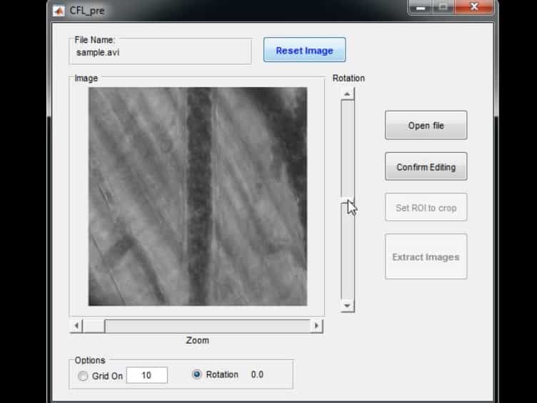 Visualization and Quantification of the Cell-free Layer in Arterioles of the Rat Cremaster Muscle