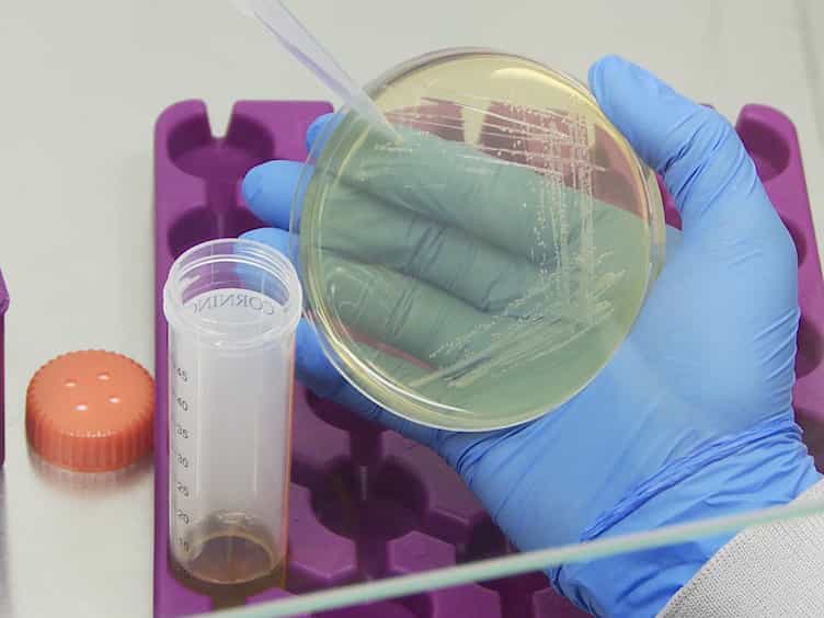 Experimental Infection with Listeria monocytogenes as a Model for Studying Host Interferon-γ Responses