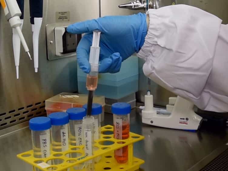 Isolation and Activation of Murine Lymphocytes