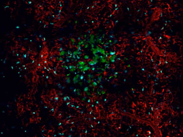 Long-term High-Resolution Intravital Microscopy in the Lung with a Vacuum Stabilized Imaging Window