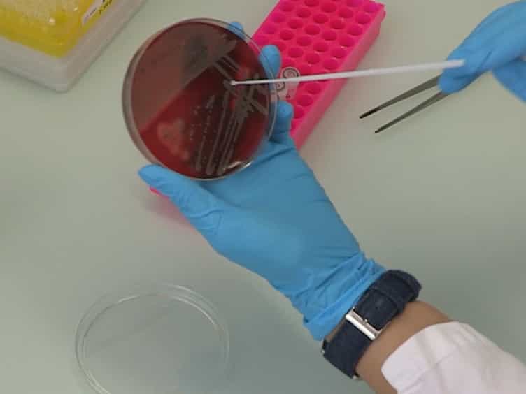 Genotyping of Staphylococcus aureus by Ribosomal Spacer PCR RS-PCR