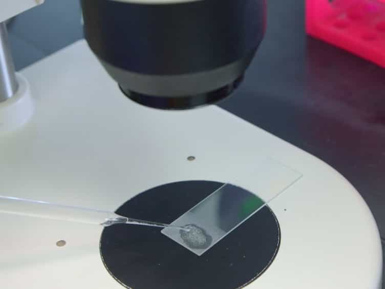 Techniques for Imaging Prometaphase and Metaphase of Meiosis I in Fixed Drosophila Oocytes