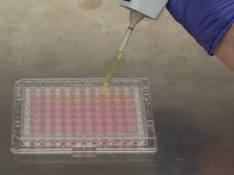 Using RNA-sequencing to Detect Novel Splice Variants Related to Drug Resistance in In Vitro Cancer Models