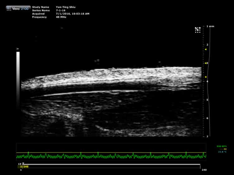 Ultrasound Assessment of Flow-Mediated Dilation of the Brachial and Superficial Femoral Arteries in Rats
