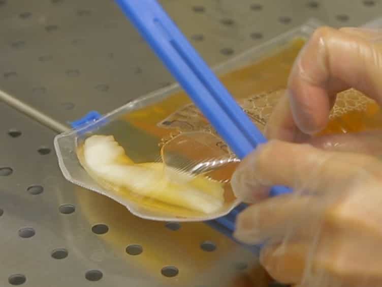 Mesenchymal Stromal Cell Culture and Delivery in Autologous Conditions: A Smart Approach for Orthopedic Applications