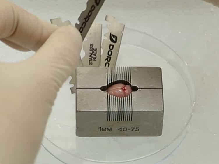 Isolation and Culture of Adult Neural Stem Cells from the Mouse Subcallosal Zone