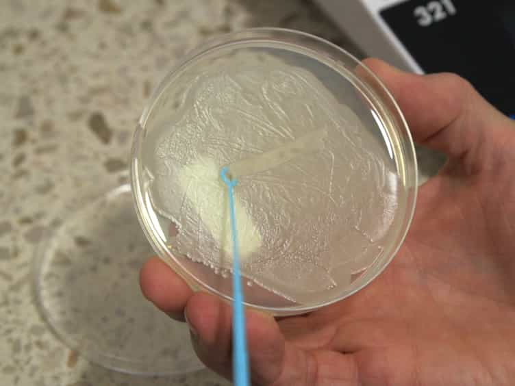 Identification of Fatty Acids in Bacillus cereus