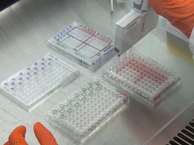 In Vitro Differentiation of Human CD4+FOXP3+ Induced Regulatory T Cells (iTregs) from Naïve CD4+ T Cells Using a TGF-β-containing Protocol