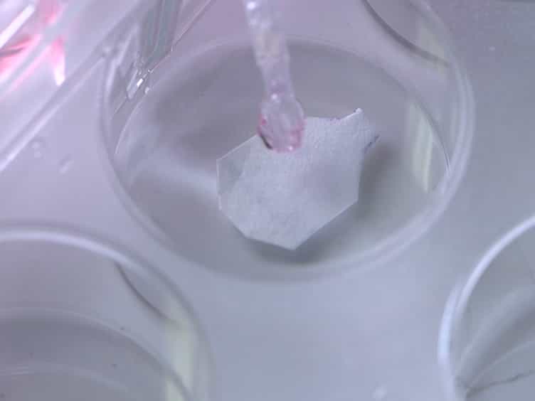 ADSC-sheet Transplantation to Prevent Stricture after Extended Esophageal Endoscopic Submucosal Dissection