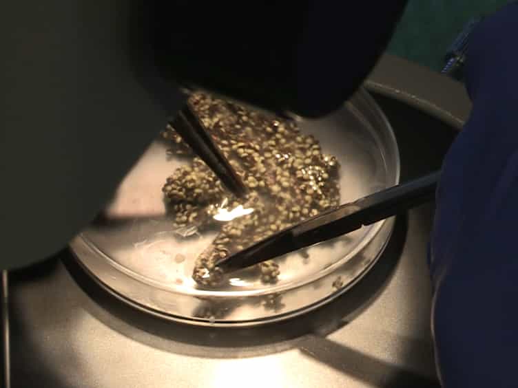 Xenopus Oocytes: Optimized Methods for Microinjection, Removal of Follicular Cell Layers, and Fast Solution Changes in Electrophysiological Experiments