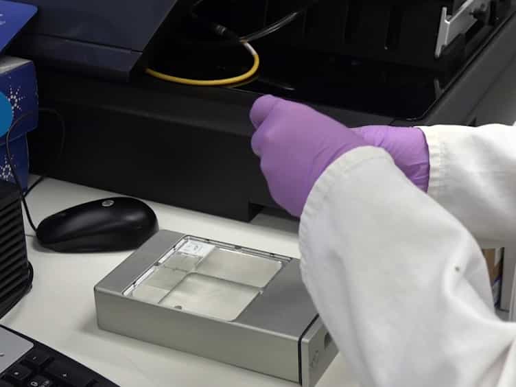 Imaging Metals in Brain Tissue by Laser Ablation - Inductively Coupled Plasma - Mass Spectrometry LA-ICP-MS