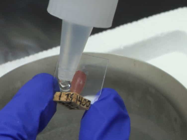 Cryosectioning of Contiguous Regions of a Single Mouse Skeletal Muscle for Gene Expression and Histological Analyses