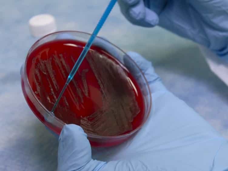 A Robust Pneumonia Model in Immunocompetent Rodents to Evaluate Antibacterial Efficacy against S. pneumoniae, H. influenzae, K. pneumoniae, P. aeruginosa or A. baumannii