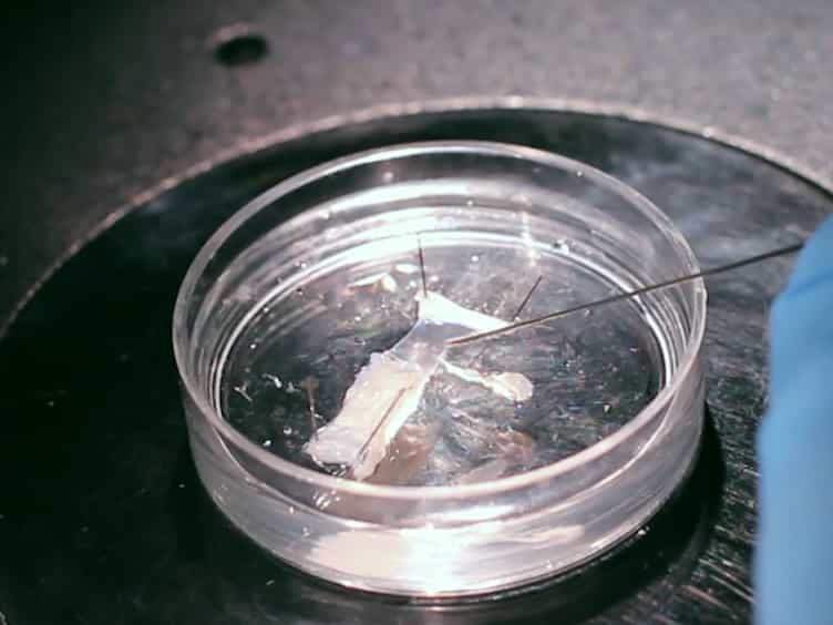 Loading a Calcium Dye into Frog Nerve Endings Through the Nerve Stump: Calcium Transient Registration in the Frog Neuromuscular Junction