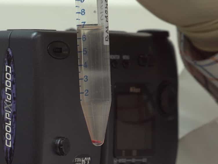 Detection of Inter-chromosomal Stable Aberrations by Multiple Fluorescence In Situ Hybridization mFISH and Spectral Karyotyping SKY in Irradiated Mice