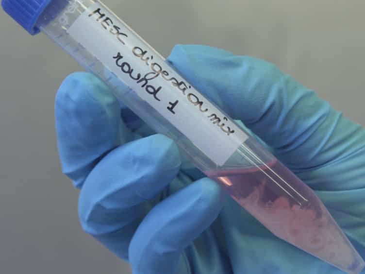Isolation of Mouse Endometrial Epithelial and Stromal Cells for In Vitro Decidualization