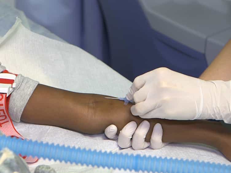 Continuous Manual Exchange Transfusion for Patients with Sickle Cell Disease: An Efficient Method to Avoid Iron Overload