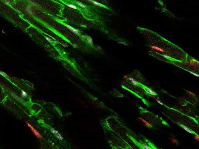 Visualization of Cell Cycle Variations and Determination of Nucleation in Postnatal Cardiomyocytes