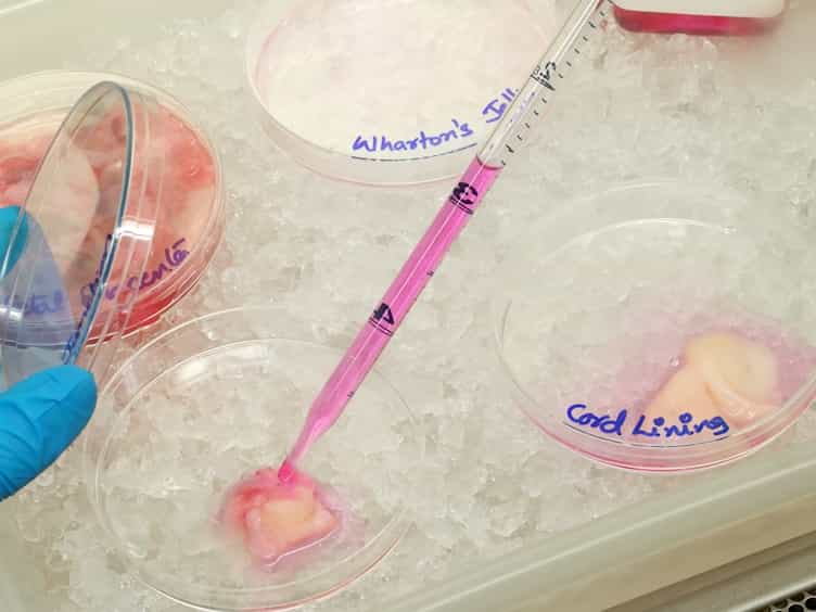 Isolation and Characterization of Mesenchymal Stromal Cells from Human Umbilical Cord and Fetal Placenta