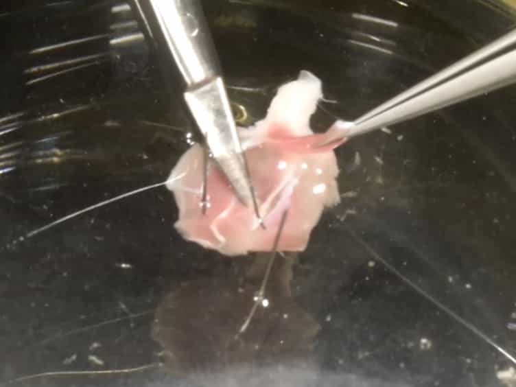 Measuring Neuromuscular Junction Functionality