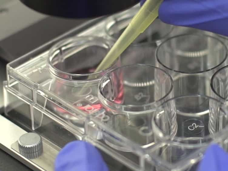 Small-scale Propagation of Human iPSCs in Serum-free Conditions for Routine Immunocytochemical Characterization