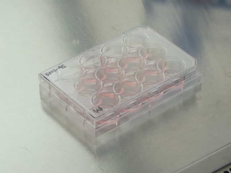 Efficient Differentiation of Pluripotent Stem Cells to NKX6-1+ Pancreatic Progenitors