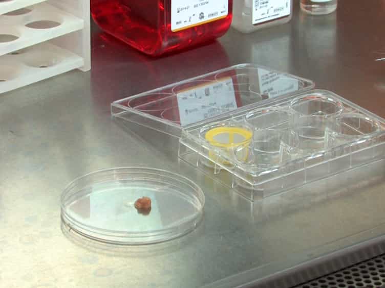 The Ex Vivo Colon Organ Culture and Its Use in Antimicrobial Host Defense Studies