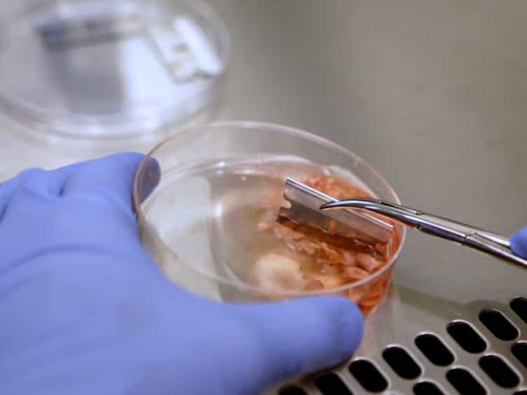 A Protocol for Rapid Post-mortem Cell Culture of Diffuse Intrinsic Pontine Glioma (DIPG)
