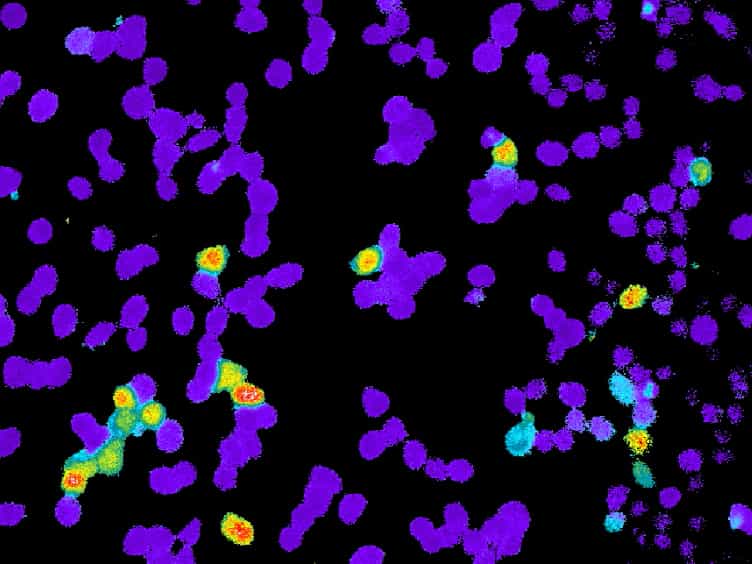Controllable Ion Channel Expression through Inducible Transient Transfection