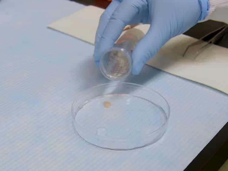 Preparation of Meiotic Chromosome Spreads from Mouse Spermatocytes