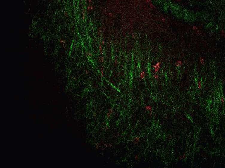 Visualizing Angiogenesis by Multiphoton Microscopy In Vivo in Genetically Modified 3D-PLGA/nHAp Scaffold for Calvarial Critical Bone Defect Repair