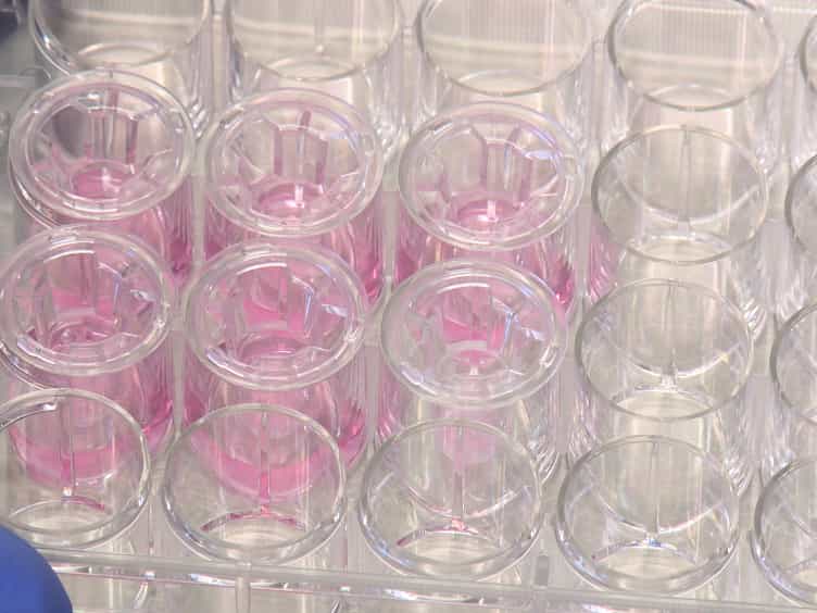 Analysis of Lymphocyte Extravasation Using an In Vitro Model of the Human Blood-brain Barrier