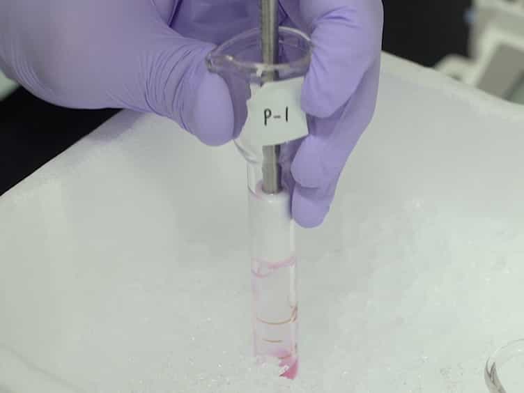 Detection of microRNA Expression in Peritoneal Membrane of Rats Using Quantitative Real-time PCR