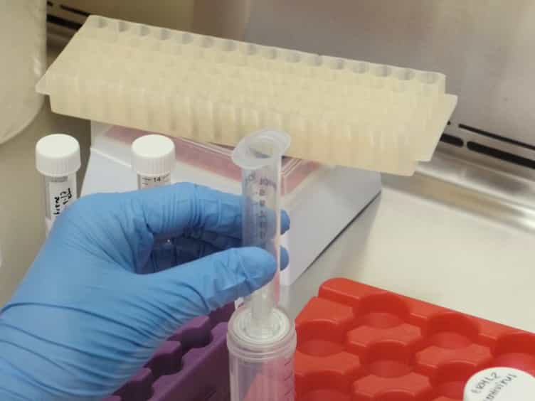 Induction of Mesenchymal-Epithelial Transitions in Sarcoma Cells