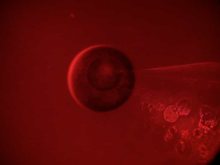 Voltage-clamp Fluorometry in Xenopus Oocytes Using Fluorescent Unnatural Amino Acids
