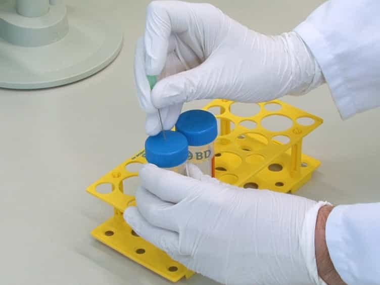 Metabolic Glycoengineering of Sialic Acid Using N-acyl-modified Mannosamines