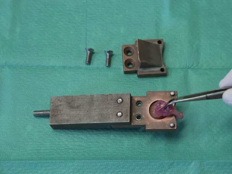Effects of Allogeneic Platelet-Rich Plasma PRP on the Healing Process of Sectioned Achilles Tendons of Rats: A Methodological Description