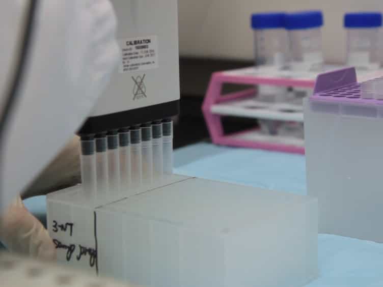 Integration of Miniaturized Solid Phase Extraction and LC-MS/MS Detection of 3-Nitrotyrosine in Human Urine for Clinical Applications