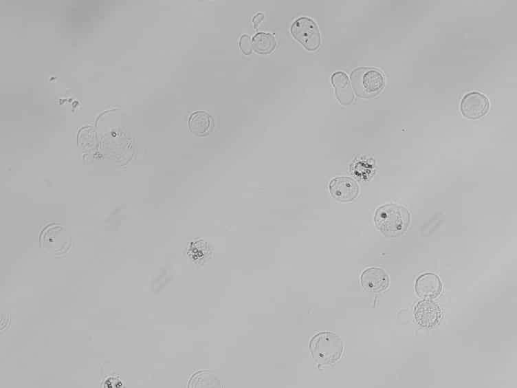 Microcrystallography of Protein Crystals and In Cellulo Diffraction