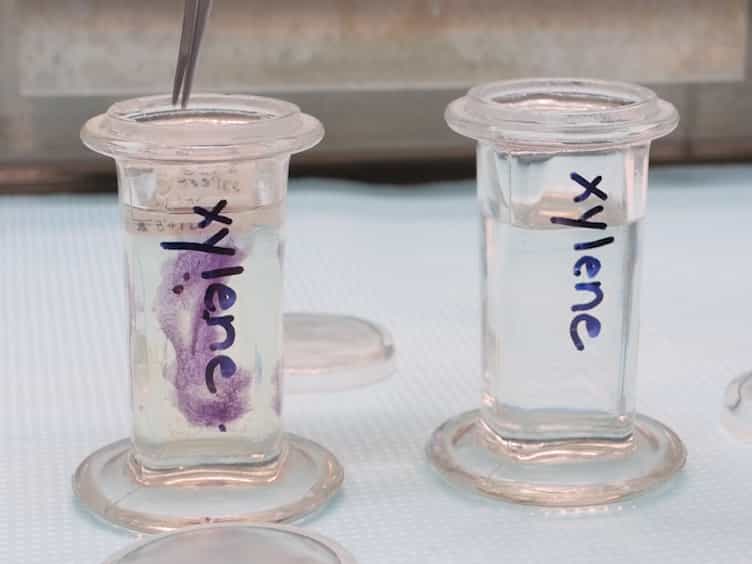 Sectioning Mammary Gland Whole Mounts for Lesion Identification