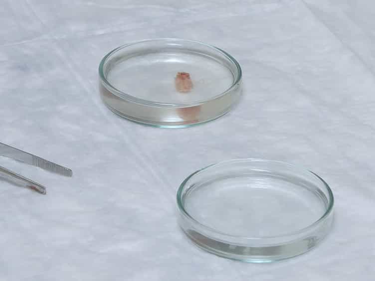 Spinal Cord Neurons Isolation and Culture from Neonatal Mice