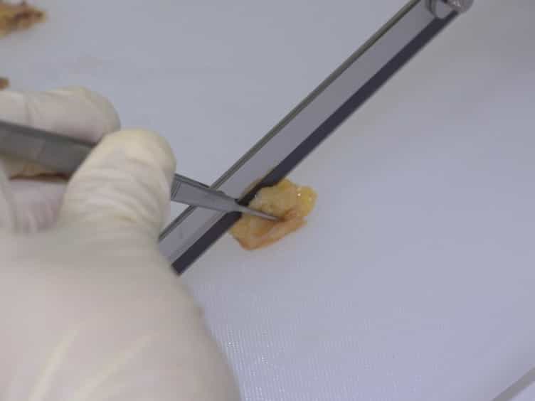 Protocol for HER2 FISH Using a Non-cross-linking, Formalin-free Tissue Fixative to Combine Advantages of Cryo-preservation and Formalin Fixation