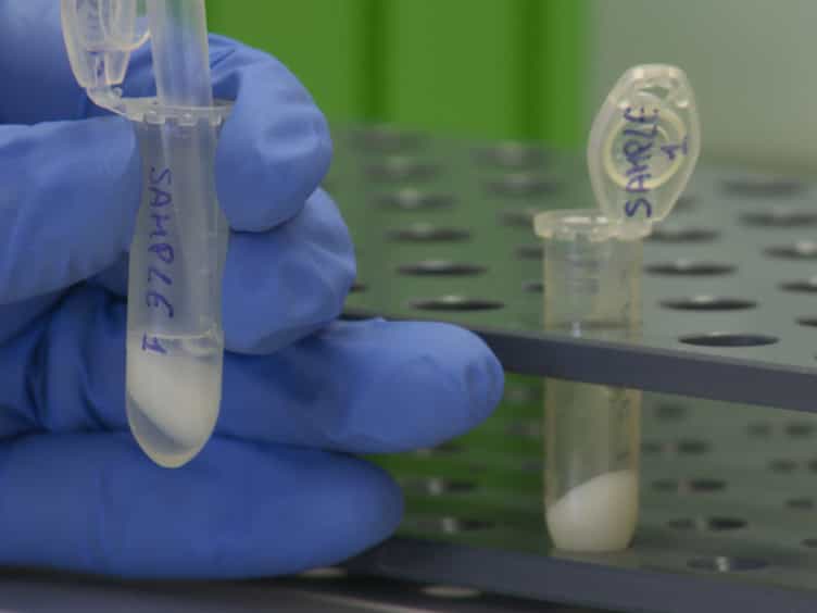 Chromatin Immunoprecipitation ChIP in Mouse T-cell Lines