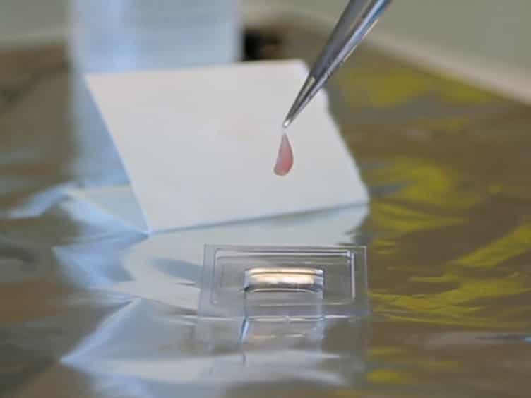 In Situ Immunofluorescent Staining of Autophagy in Muscle Stem Cells