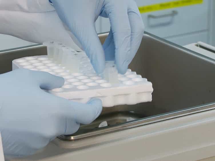 Peptide and Protein Quantification Using Automated Immuno-MALDI (iMALDI)