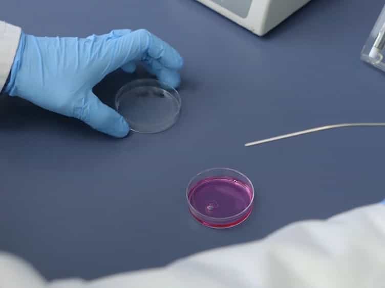 Determining Cell-surface Expression and Endocytic Rate of Proteins in Primary Astrocyte Cultures Using Biotinylation