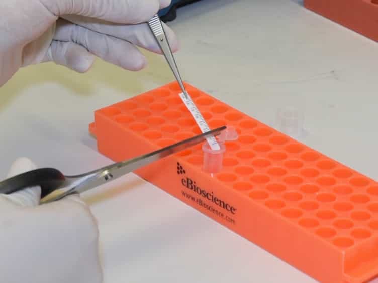 Bead Based Multiplex Assay for Analysis of Tear Cytokine Profiles